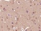 IGLC1 Polyclonal Antibody