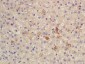 CES1/Liver Carboxylesterase 1 Polyclonal Antibody