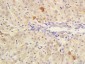 CES1/Liver Carboxylesterase 1 Polyclonal Antibody