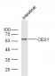 CES1/Liver Carboxylesterase 1 Polyclonal Antibody