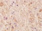 LMAN1L Polyclonal Antibody