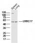 LRRC17 Polyclonal Antibody