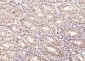 LSM6 Polyclonal Antibody