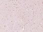 MEPCE Polyclonal Antibody