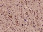 NDOR1 Polyclonal Antibody