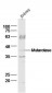 Mutarotase Polyclonal Antibody
