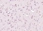 Nesprin 1 Polyclonal Antibody