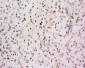 SARA Polyclonal Antibody