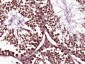 NUP155 Polyclonal Antibody