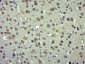 RAB30 Polyclonal Antibody