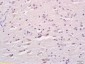 LCAT Polyclonal Antibody