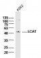 LCAT Polyclonal Antibody