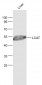 LCAT Polyclonal Antibody