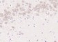 LCAT Polyclonal Antibody