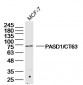PASD1/CT63 Polyclonal Antibody