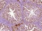 SMCHD1 Polyclonal Antibody