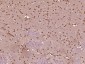 SMCHD1 Polyclonal Antibody
