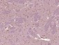 SMCHD1 Polyclonal Antibody