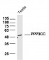 PPP3CC Polyclonal Antibody