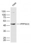 PPP3CC Polyclonal Antibody