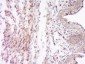 SOCS7 Polyclonal Antibody