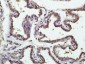 SNRPE Polyclonal Antibody