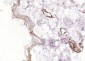 POU2F3 Polyclonal Antibody