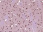p66 alpha/GATAD2A Polyclonal Antibody