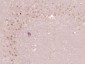 p66 beta/GATAD2B Polyclonal Antibody