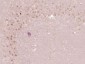 p66 beta/GATAD2B Polyclonal Antibody