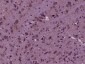 RABGGTA Polyclonal Antibody