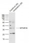 MTNR1B  Polyclonal Antibody
