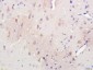 Spindly Polyclonal Antibody