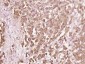 CXCL10/IP10 Polyclonal Antibody