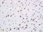 BDKRB2 Polyclonal Antibody