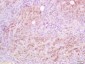 CD5L Polyclonal Antibody