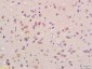 CHRNA2(neuronal) Polyclonal Antibody