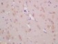 KCNC3 Polyclonal Antibody