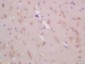 KCNC3 Polyclonal Antibody