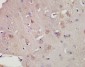 KCNC3 Polyclonal Antibody