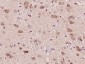 IL22BP Polyclonal Antibody