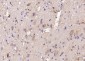 STXBP1/Munc18-1 Polyclonal Antibody