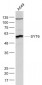 SYT6 Polyclonal Antibody