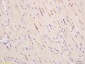ITPR2 Polyclonal Antibody