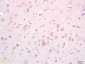 EBF3 Polyclonal Antibody