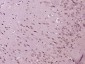 5HT3B receptor Polyclonal Antibody