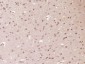SETBP1 Polyclonal Antibody