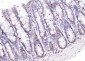AKR1D1 Polyclonal Antibody