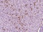 ACOX2 Polyclonal Antibody