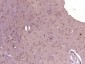 ACOX2 Polyclonal Antibody